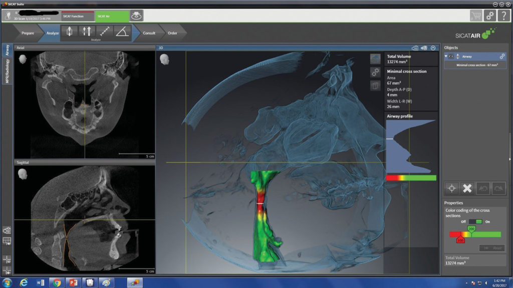 cbct scan hartrick