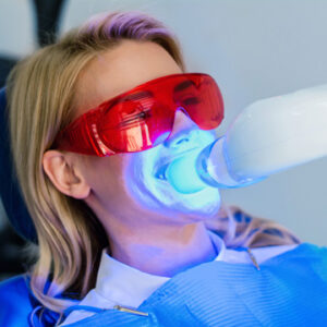 questions about teeth whitening